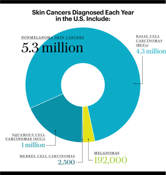 Skin Cancer Picture Chart