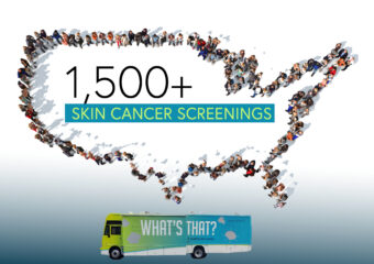 It’s been a smashing summer for the Destination Healthy Skin free skin cancer screening and education program. During July, we traveled up the west coast before heading back east in August where we ended the month by surpassing our 2023 goal of 1,500 free screenings. And we’re not done yet! 