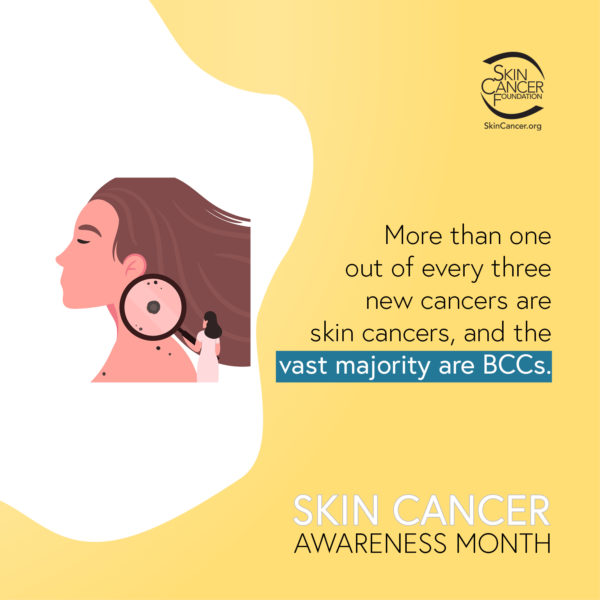 More than one out of every 3 new cancers are skin cancers, and the vast majority are BCCs