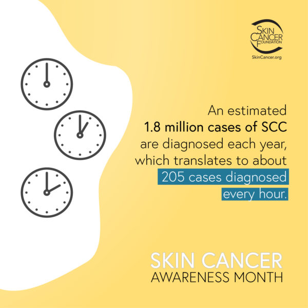 An estimated 1.8 million cases of SCC are diagnosed each year, which translates into about 205 cases diagnosed every hour