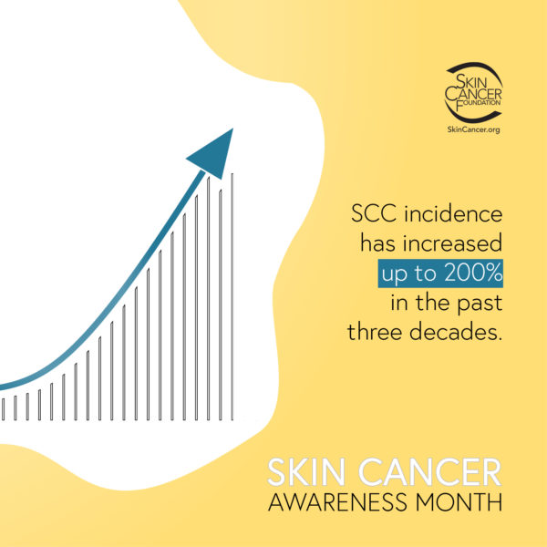 SCC incidence has increased up to 200% in the past 3 decades
