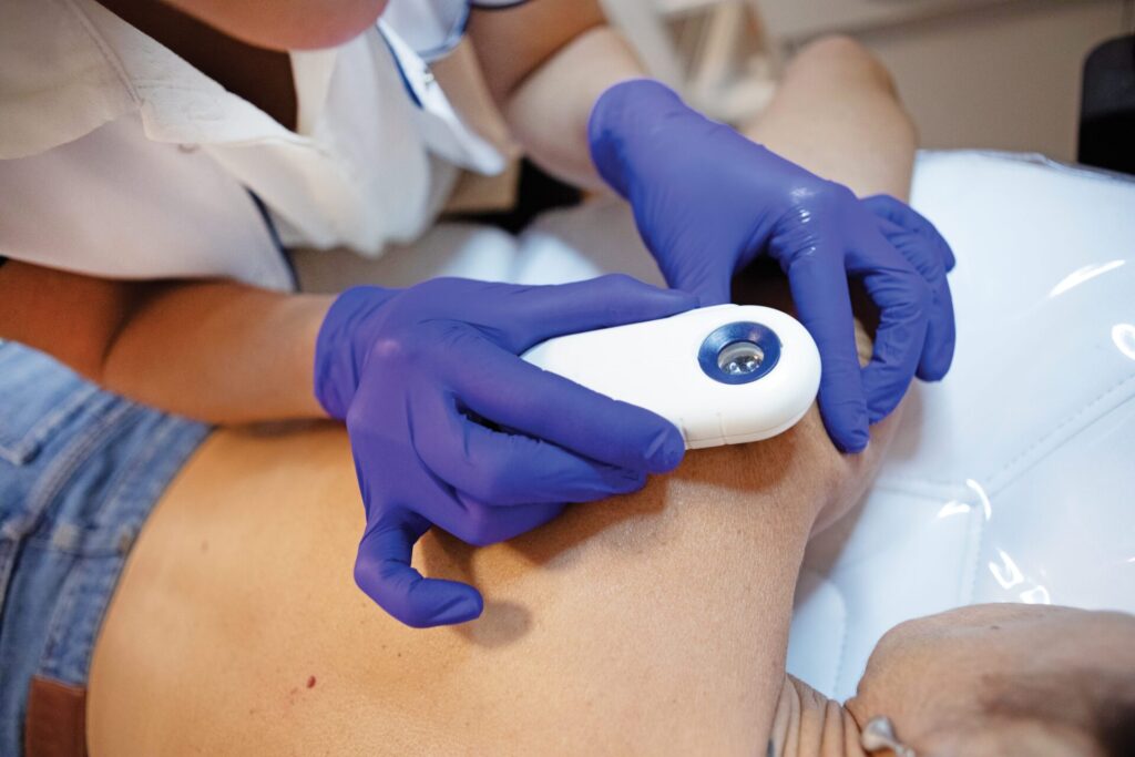 A cosa serve quella piccola cosa con l'oculare che il mio dermatologo posiziona in diversi punti durante la visita dermatologica?