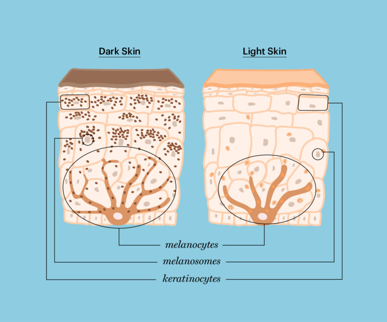 Are People of Color at Risk for Skin Cancer?