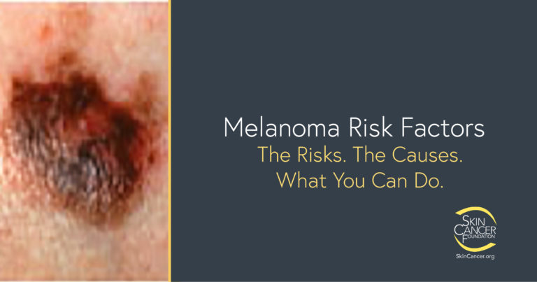 Art work showing a picture of melanoma and including the caption Melanoma Risk Factors