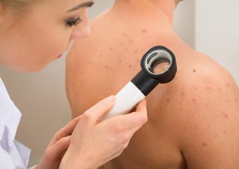 Sometimes identifying a potential skin cancer isn’t so straightforward. Skin cancer comes in many forms, and tumors don’t always display the most well-known characteristics of the disease.