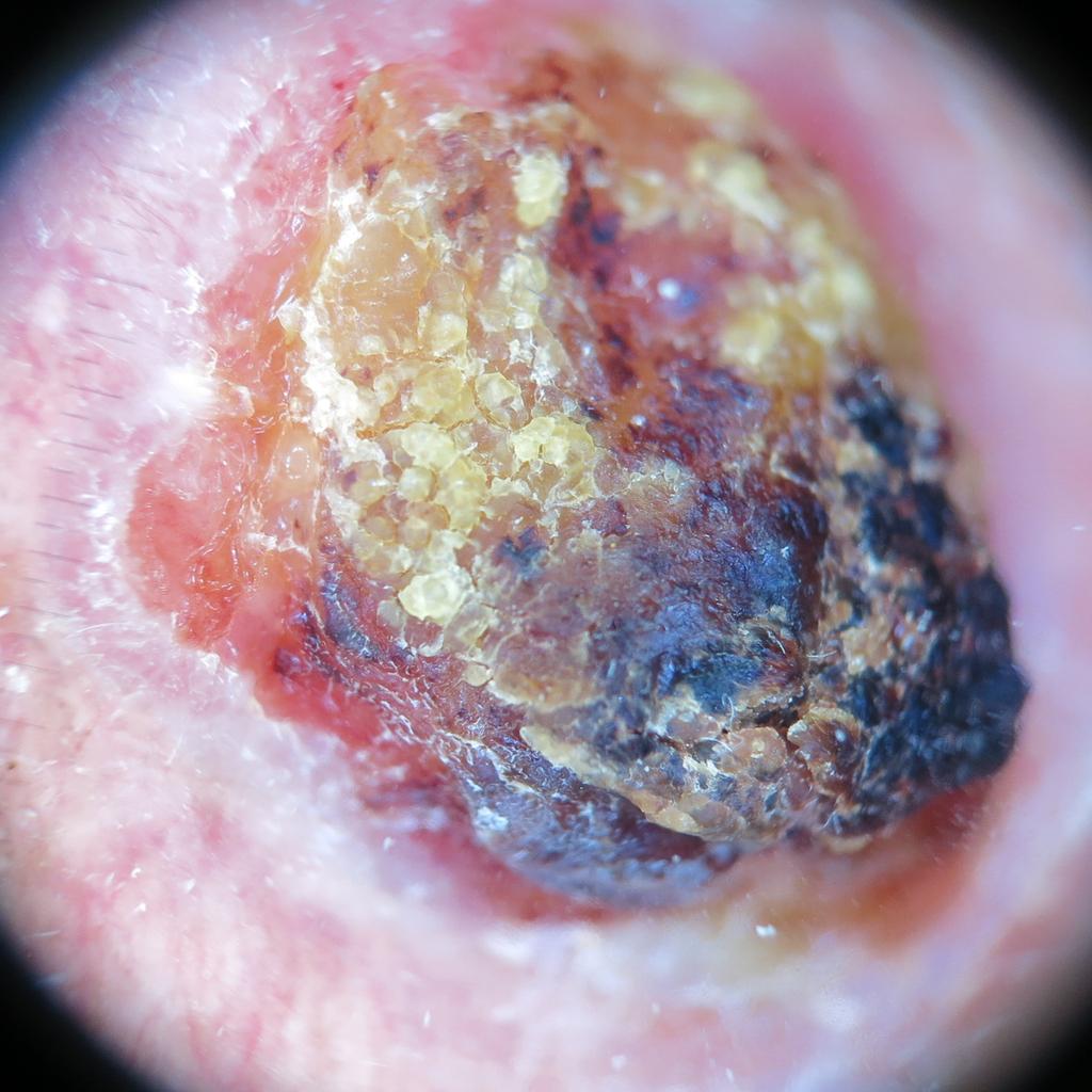 SCC2