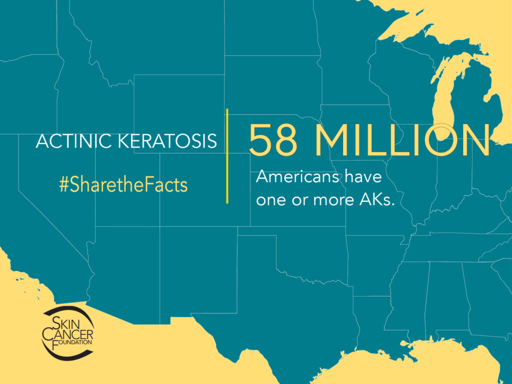 58 million Americans have one or more actinic keratoses