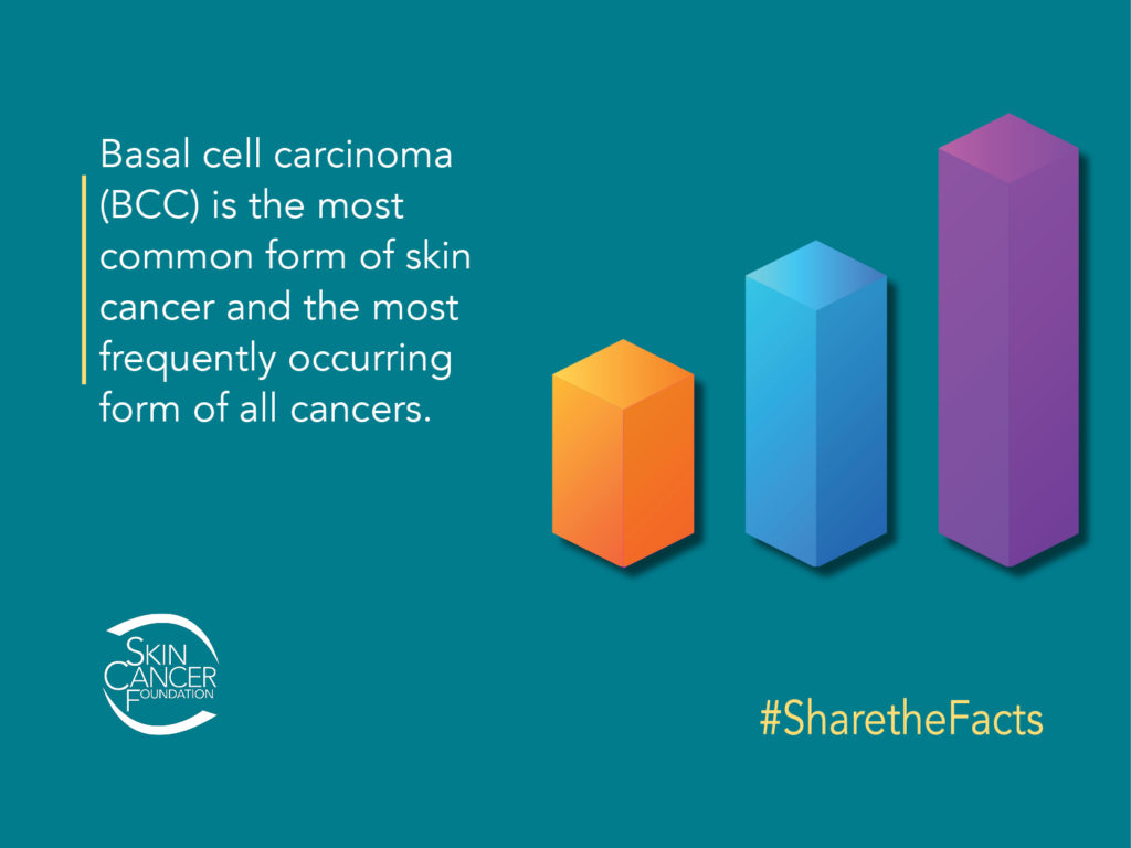 Basal cell carcinoma (BCC) is the most common form of skin cancer and the most frequently occurring form of all cancers