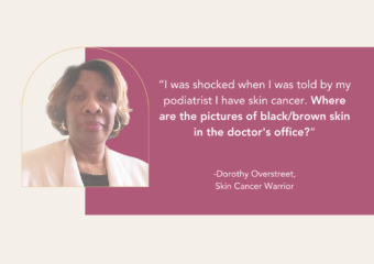 Most people who go to the podiatrist would never expect to get biopsied and diagnosed with a rare, dangerous skin cancer. But that’s exactly what happened to Dorothy Overstreet. Now, she wants to educate people about acral lentiginous melanoma (ALM) and how to detect it.  
