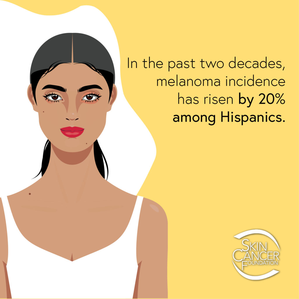 Skin Cancer In People Of Color Skin Cancer In People Of Color
