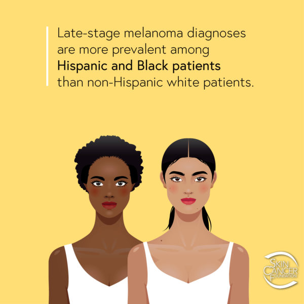 Diagnósticos de melanoma em estágio avançado são mais prevalentes entre pacientes hispânicos e negros do que em pacientes brancos não hispânicos