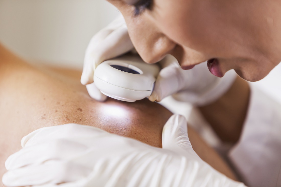 Dermatology Care: Nurturing Skin Health