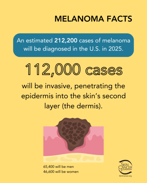 melanoma facts 112 cases