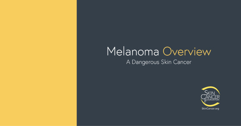 Banner with text about melanoma. Symptoms, cancerous mole, malignant melanoma.
