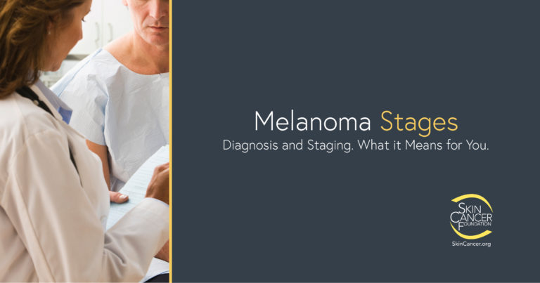 Stages of Melanoma Information
