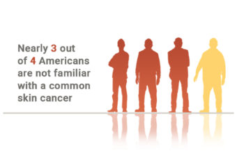 Infographic about skin cancer knowledge