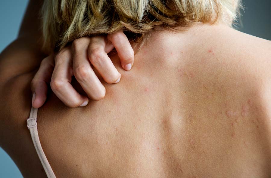 Can Skin Cancer Appear as a Rash?