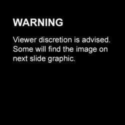 Warning: Viewer discretion is advised. Some will find the image on the next slide graphic.