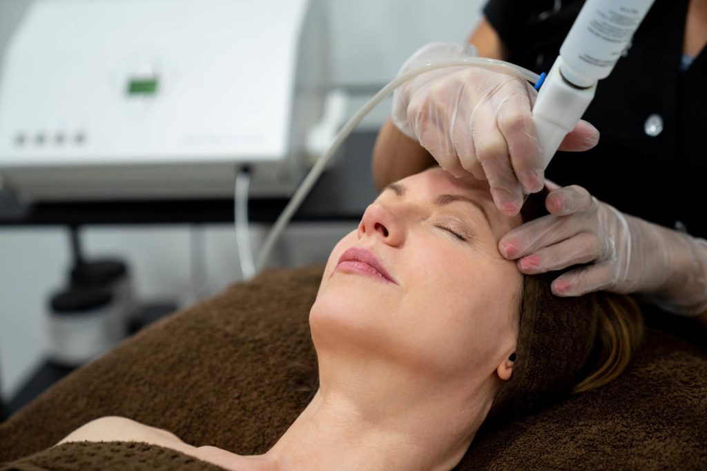 woman laser treatment face