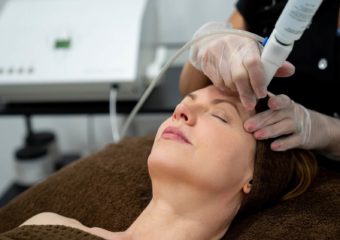 woman laser treatment face